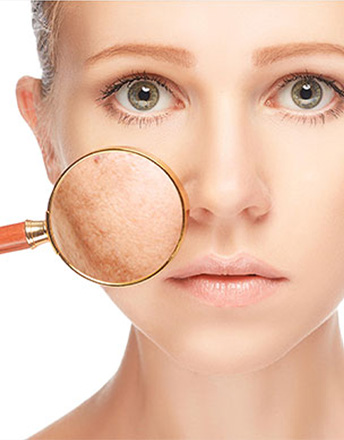 freckles-and-blemishes-treatment_livewell