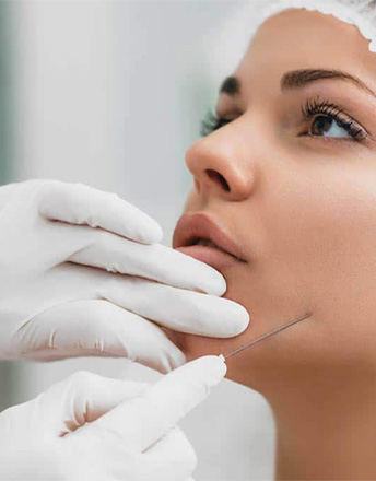 thread-lift-treatment_livewell