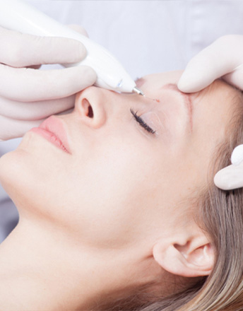 warts-removal-treatment_livewell